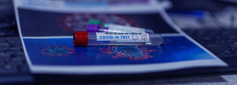 Image showing testing vial with indicating a negative test result for coronavirus.